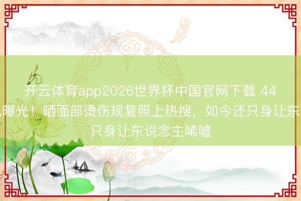 开云体育app2026世界杯中国官网下载 44岁杨蓉近况曝光！晒面部烫伤规复照上热搜，如今还只身让东说念主唏嘘